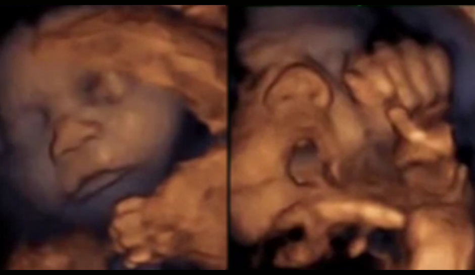 music in the womb